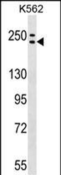 ADCY9 Antibody (C-term)