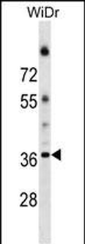 ALG5 Antibody (Center)
