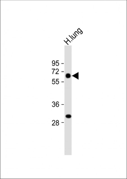 CALCRL Antibody (Center)