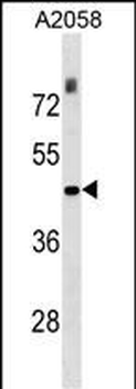 THOC3 Antibody (N-term)