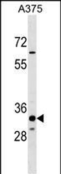 THEM5 Antibody (Center)