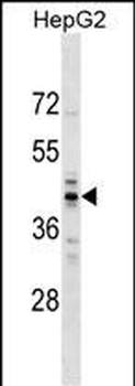 RG9MTD2 Antibody (Center)