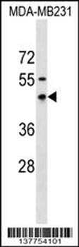 RNFT1 Antibody (N-term)