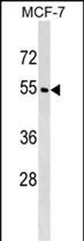 WDR20 Antibody (N-term)