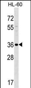 SPOCK3 Antibody (N-term)