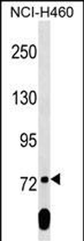 SCML2 Antibody (Center)