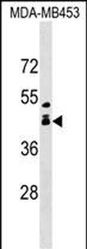 ALX1 Antibody (Center)