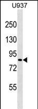 ZNF225 Antibody (N-term)