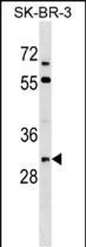Mouse Tssk3 Antibody (C-term)