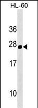 Mouse Hoxc5 Antibody (C-term)