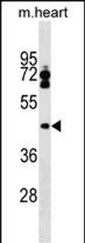 LPXN Antibody (Center)