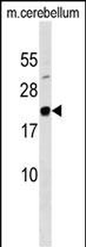 MAFG Antibody (N-term)