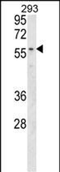 MBOAT2 Antibody (Center)