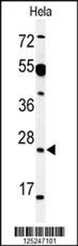 AKIR1 Antibody (C-term)