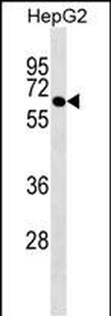 ROD1 Antibody (N-term)
