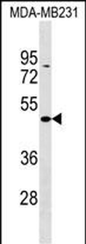 ZBTB25 Antibody (C-term)