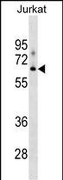 XYLB Antibody (N-term)