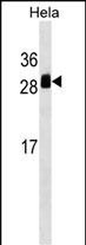 TMED1 Antibody (Center)