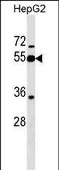 PI16 Antibody (Center)