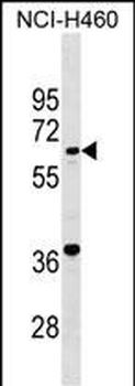 PET112L Antibody (N-term)