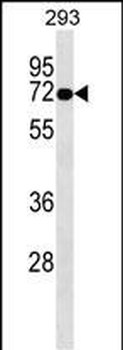 OTOP2 Antibody (Center)