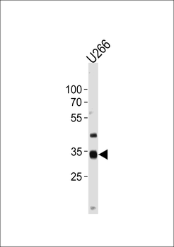 NKX3-2 Antibody (Center)