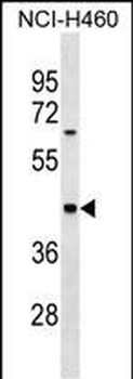 MYBPH Antibody (C-term)