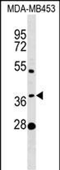 MTHFSD Antibody (N-term)