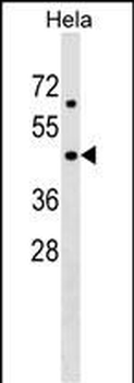 LASS6 Antibody (C-term)