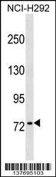 KHNYN Antibody (C-term)