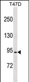 CCDC66 Antibody (C-term)