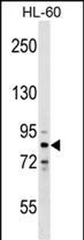 ZNF224 Antibody (N-term)