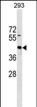 ZNF331 Antibody (N-term)