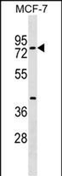 TOX4 Antibody (N-term)