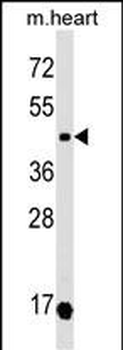OXTR Antibody (N-term)
