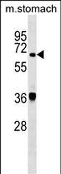 TDP1 Antibody (Center)
