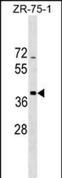 SCO2 Antibody (C-term)
