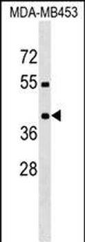 PRRT2 Antibody (Center)