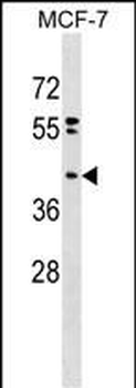 PPAPDC2 Antibody (N-term)