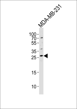 CRISP1 Antibody (C-term)