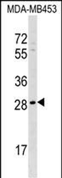 AIDA Antibody (C-term)