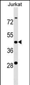 KCTD9 Antibody (Center)