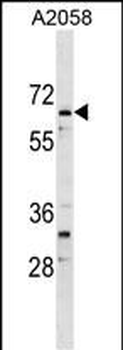 ARID5A Antibody (Center)