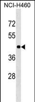 TOR3A Antibody (Center)