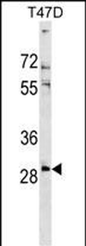 RNF138 Antibody (Center)