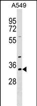 RBM11 Antibody (N-term)