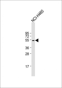 KRT36 Antibody (N-term)