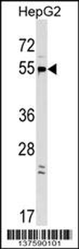 GPR22 Antibody (Center)