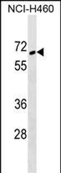 ZNF83 Antibody (N-term)
