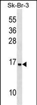 UTS2D Antibody (N-term)